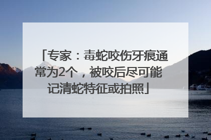 专家：毒蛇咬伤牙痕通常为2个，被咬后尽可能记清蛇特征或拍照